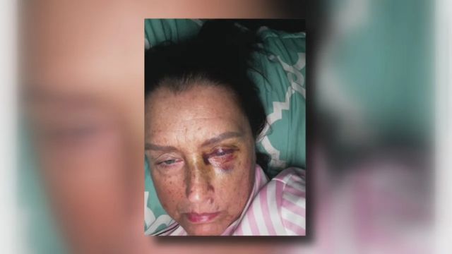 Restaurant Manager Punched in the Eye for Lemonade by Dissatisfied Customer and also a Convicted Felon in Michigan