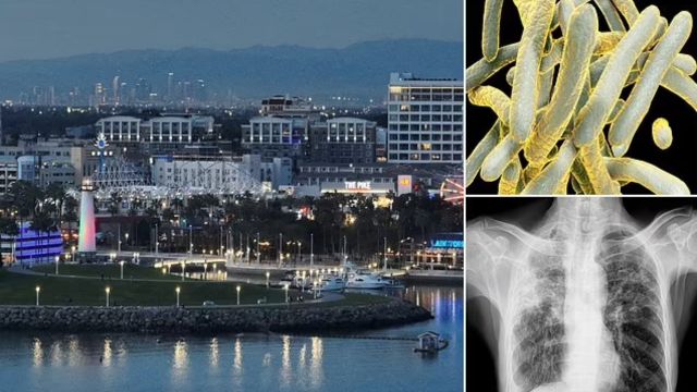 Tuberculosis in California killed One and Infects 14 others; Officials Declare a Health Emergency