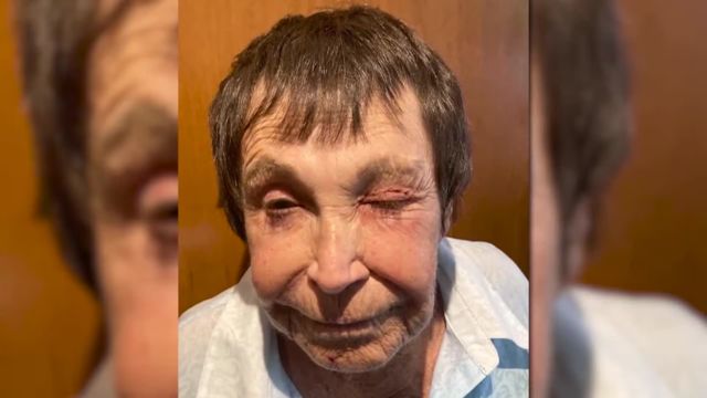 Police Have Shared a Photo of the Suspect in the Attack on an 89-year-old Comedian