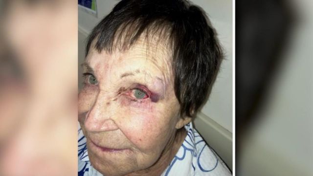 90-Year-Old NYC Comedian Allegedly Punched by Woman, Leading to Arrest