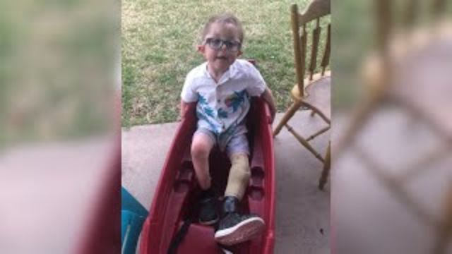 Community Rallies to Help 9-Year-Old Boy Replace Lost Prosthetic Leg in Record Time