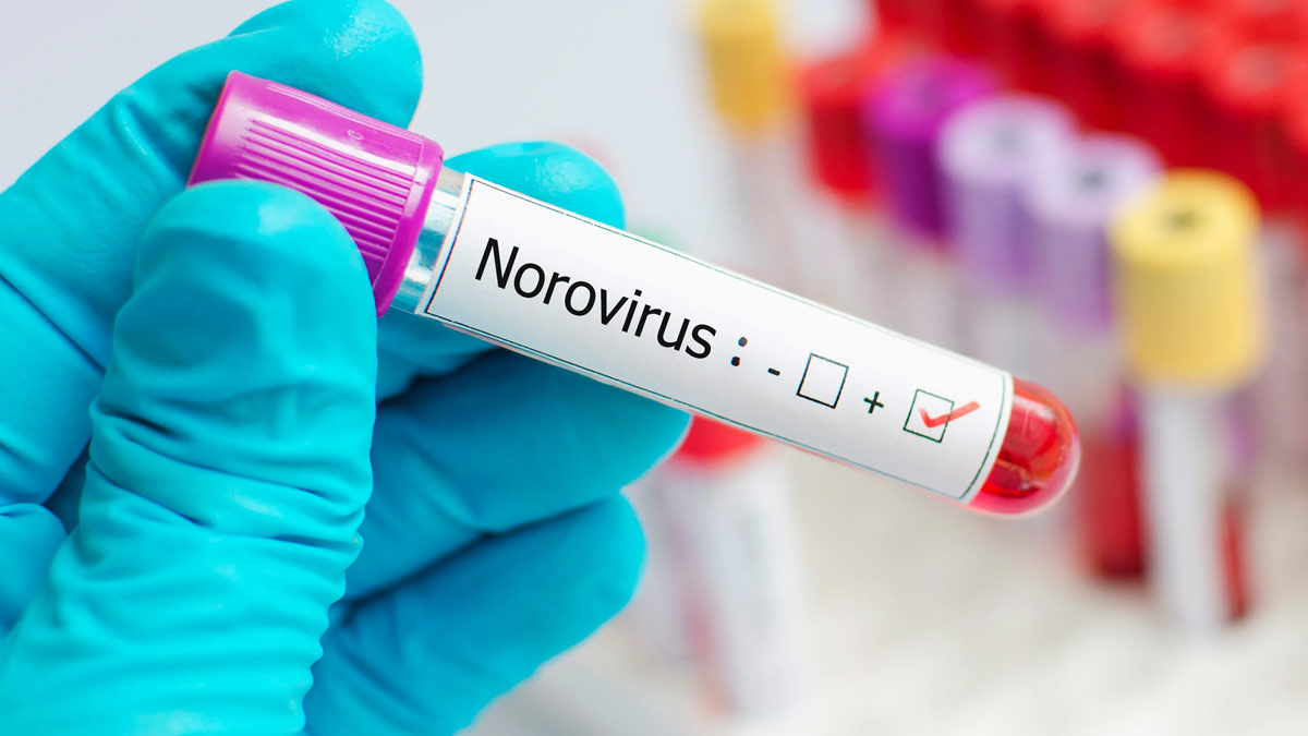 Norovirus Outbreaks Increase Nationwide: Tips on Preventing Infection and Staying Safe