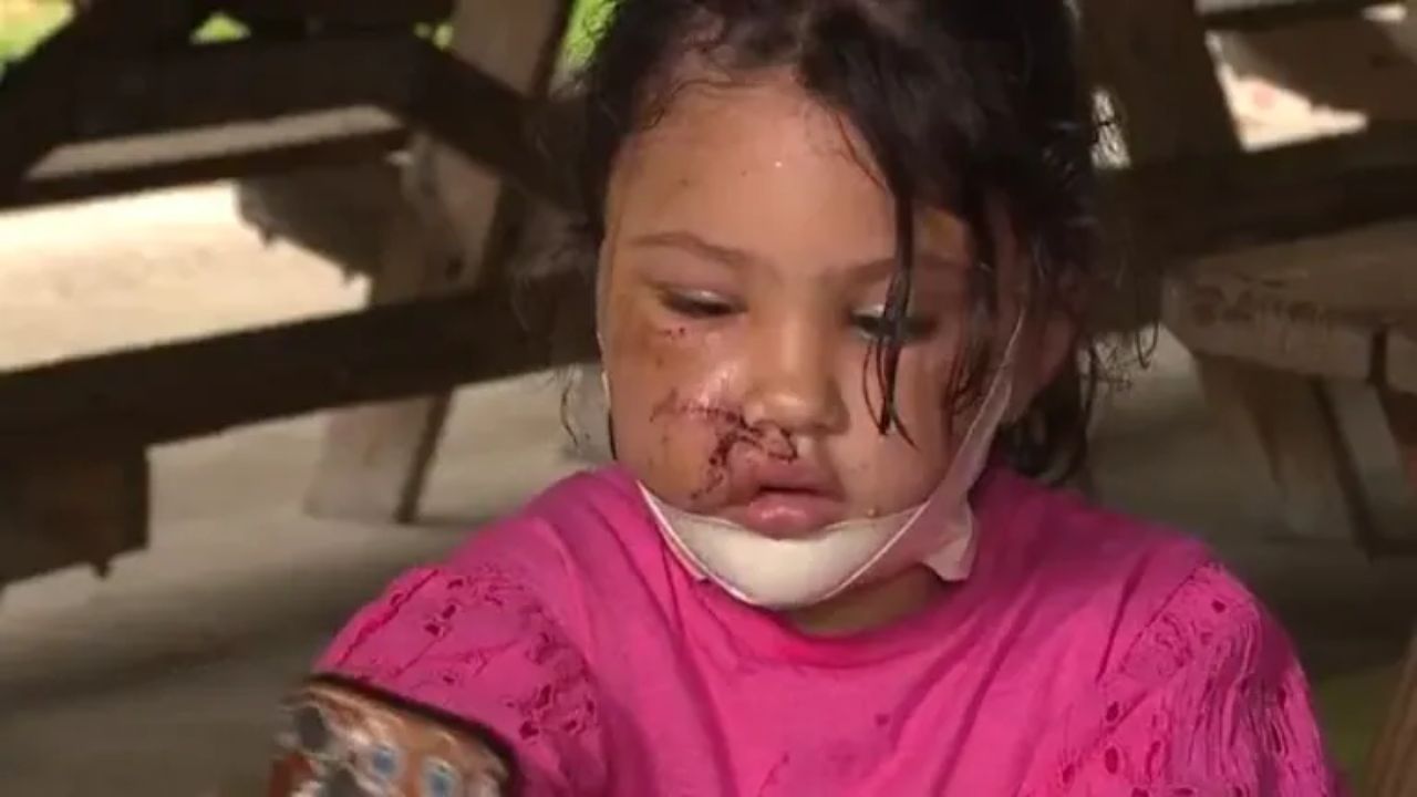 Dog Euthanized After Brutal Attack on 4-Year-Old Girl and Her Mother in Ohio