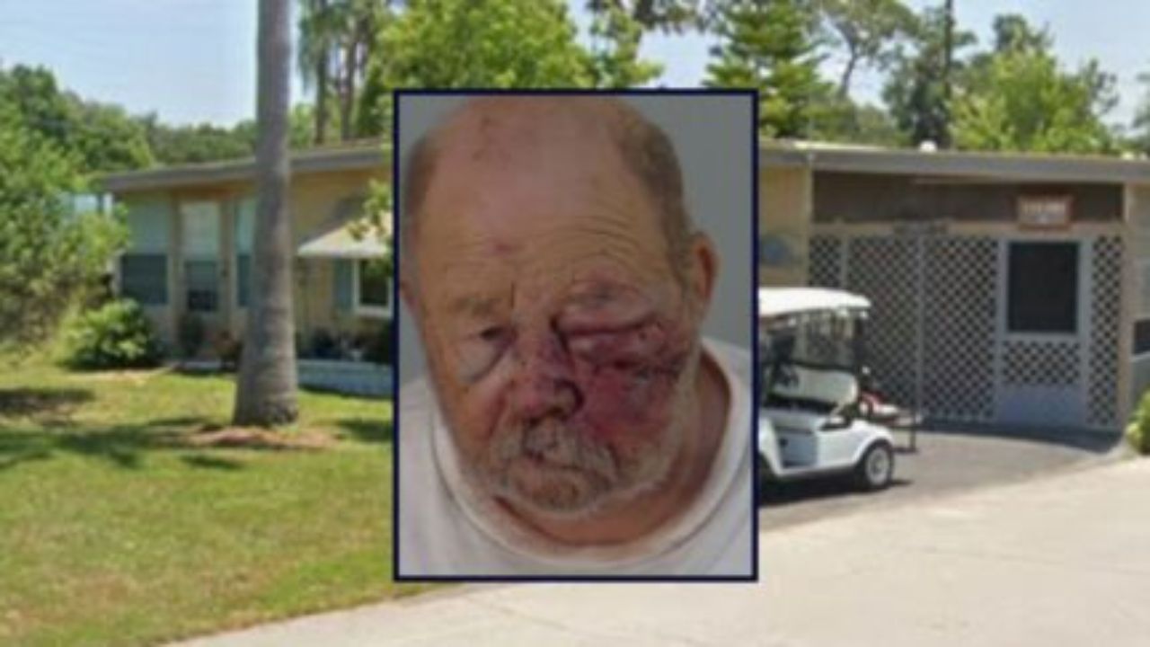 Florida Man Shoots Woman After Insulting Her Before Card Game, Then Gets Beaten by Her Husband, Deputies Say