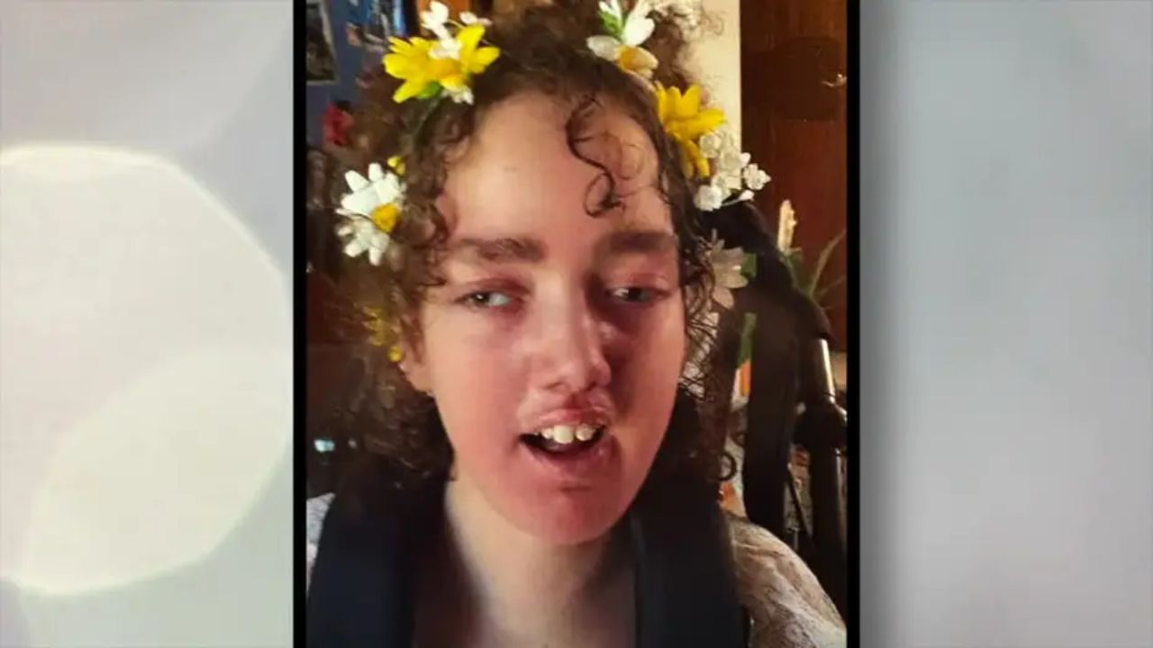 Wisconsin Judge Dismisses Lawsuit After Hospital Accidentally Disposes of Patient’s Donated Brain Tissue