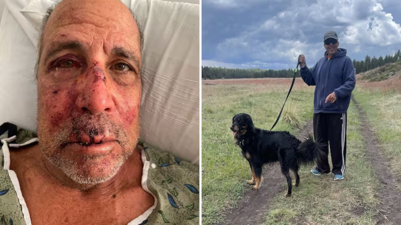 71-Year-Old Arizona Man Battling Brain Tumor Recovering After Brutal Park Attack While Walking Dog